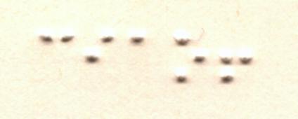 figure/a2-braille-lettura